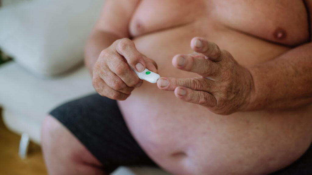 oxidative stress in obesity and diabetes